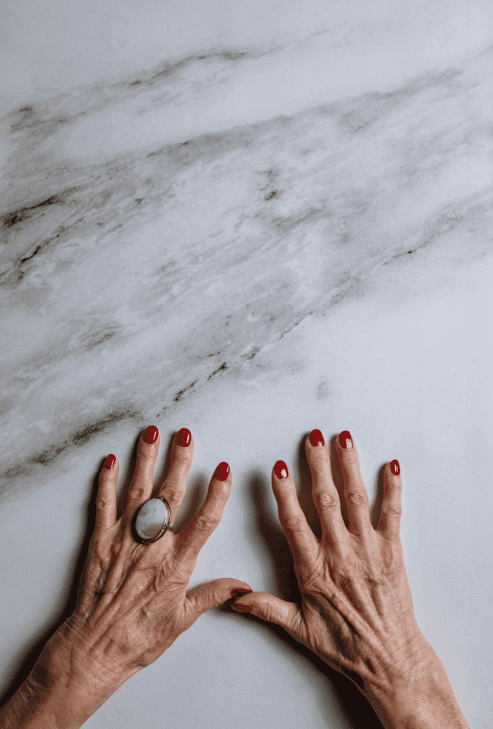 Arthritic hands showing joint inflammation and pain that water fasting can help by reducing systemic inflammation