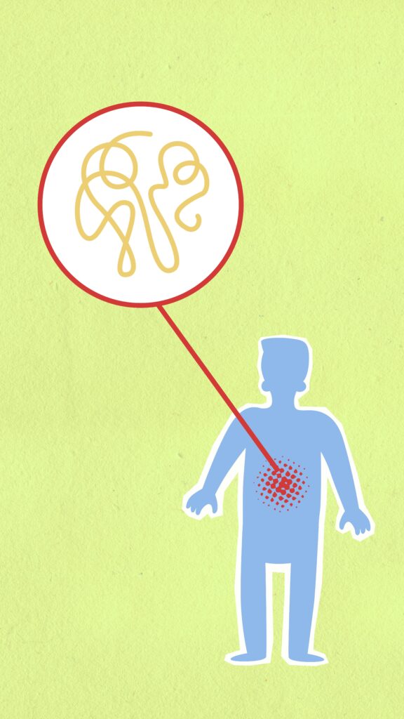 Illustration of gut inflammation representing autoimmune disease and how water fasting supports healing